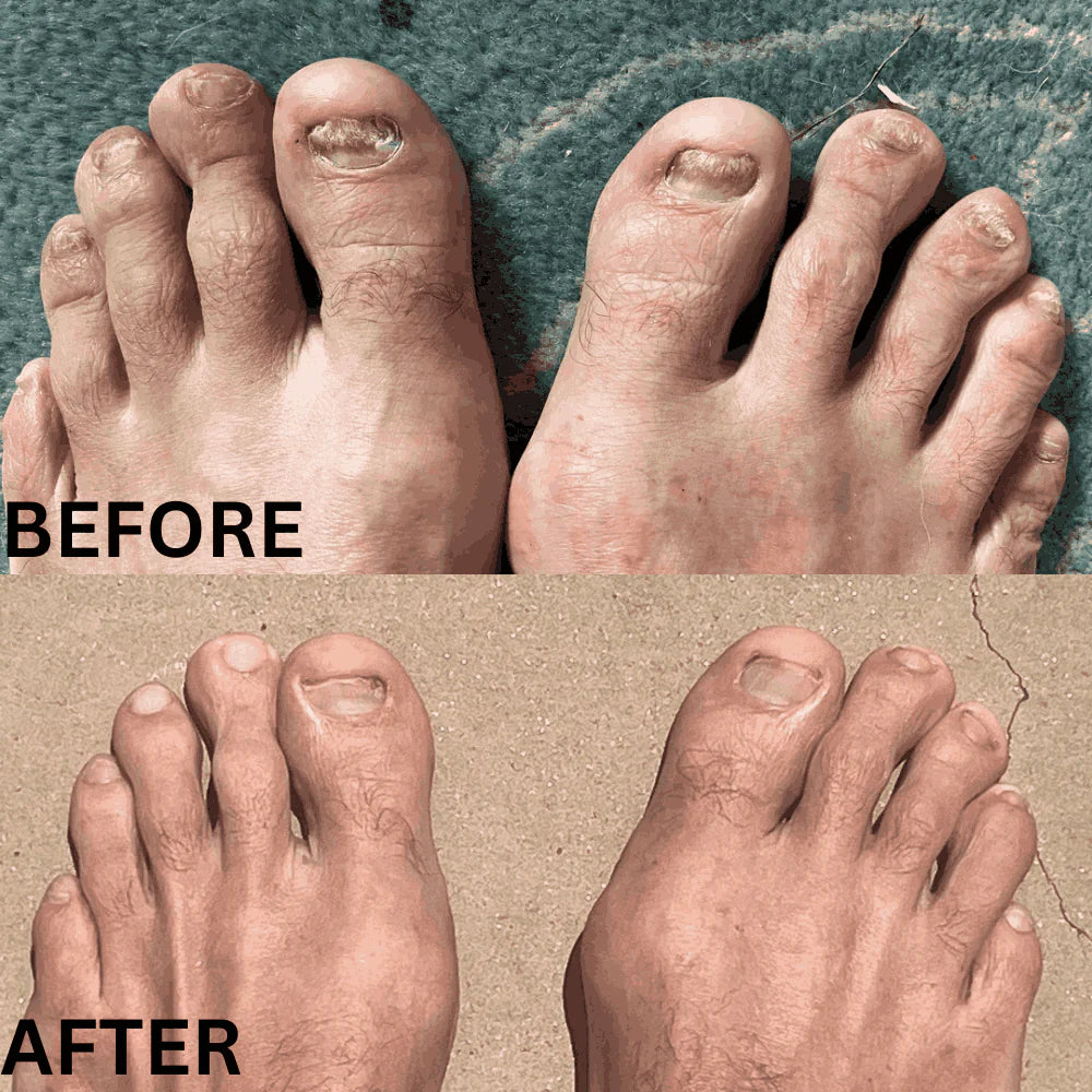 Swisscure™ - Your Path to Healthier-Looking Nails .